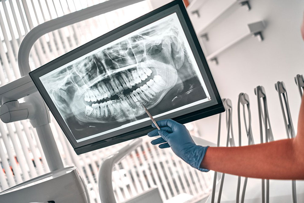 dental-x-rays-your-window-to-oral-health